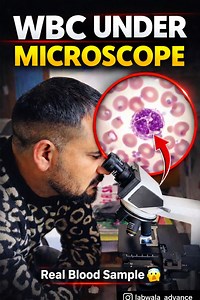 Is video me hum aapko WBC (White Blood Cell) ko microscope ke niche real blood sample me dikhate hain 🔬Agar aap CBC test, blood report, ya infection ke baare me samajhna chahte hain, to ye video aapke liye hai.WBC body ke soldiers hote hain jo infection se ladte hain 💪👉 Follow @labwala_advance for real lab knowledge👉 Share with medical & non-medical friends | Labwala advance