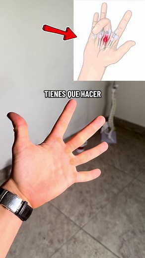 Fortalecer los extensores de los dedos para la salud de las manos