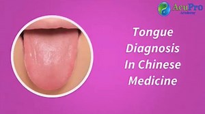 2.7K views · 120 reactions | Basic explanation for tongue diagnosis in Chinese medicine. If you want more, check out my post all on Observation in TCM: https://acuproacademy.com/tcm-diagnosis-made-easy-observation-method/ | AcuPro Academy | Facebook