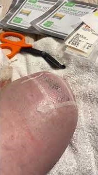 Wound Care Wednesday: Dressing Change for a BKA Stump