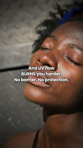 Why You Should NEVER Use Retinol In The Morning ☀️