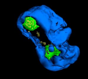 File:3D-Reconstruction-of-VZV-Infected-Cell-Nuclei-and-PML-Nuclear-Cages-by-Serial-Section-Array-ppat.1002740.s005.ogv - Wikimedia Commons