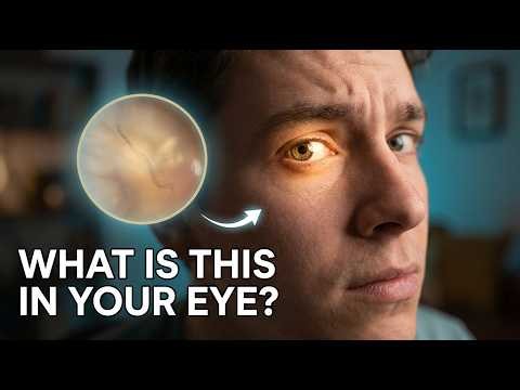 Eye Floaters & Flashes: Normal or a Warning Sign?