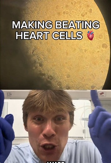 How and why did I make human beating heart cells in a dish for my MSc in Genomic Medicine at Oxford University? Watch to find out! Day 235 If you made it to the end of the video please comment “Happy researching!” or “🐔” (my favourite animal). It’s free and helps my channel grow! Follow me on my journey to try cure Marfan syndrome and complete my PhD in Stem Cell Biology at the University of Cambridge! Over 1,700 hours completed towards the PhD 💪🥼🧬👨‍🔬🧫 Want a 3-step Master’s application g