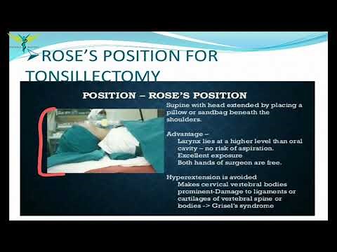 Tonsillectomy | ENT |Steps | Indications and contradictions | post operative care | Complications