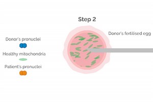 Pioneering IVF technique which created eight healthy babies unveiled by researchers