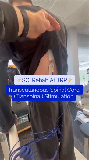 👀 See what we’re up to at TRP! We’ve been integrating Transpinal Stimulation (TSS) into our gait training with our SCI patients, pairing innovative technology with functional movement. 🧠 What is TSS? •A non-invasive neuromodulation intervention •Delivered through surface electrodes on the spine •Helps activate the nervous system to improve function ❓Why pair with walking? ✅Walking is one of the top recovery goals after spinal cord injury 🔥TSS is best when paired with high-intensity interventi