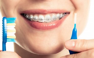 Σιδεράκια: Χρήσιμες συμβουλές όταν τα βάλεις - ΜΑΡΙΑ ΚΑΡΥΔΑΚΗ ΟΡΘΟΔΟΝΤΙΚΟΣ