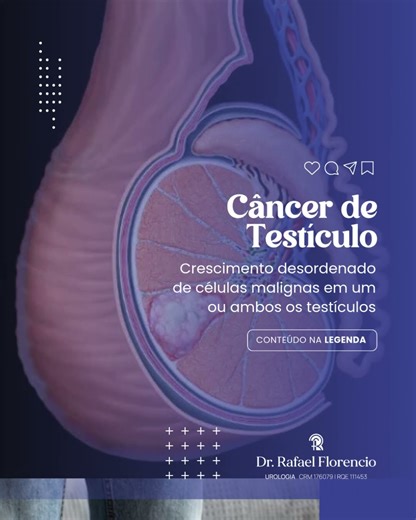 Câncer de testículos: fique atento aos sinais #urologistasp #urologista
