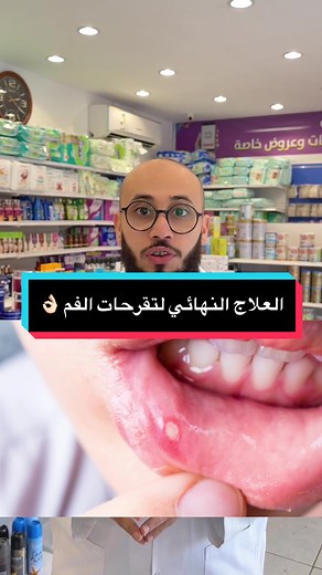 العلاج الفعال لتقرحات الفم