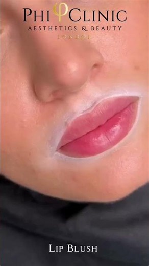 Lip Blush is the perfect treatment for anyone looking to enhance their natural lips.