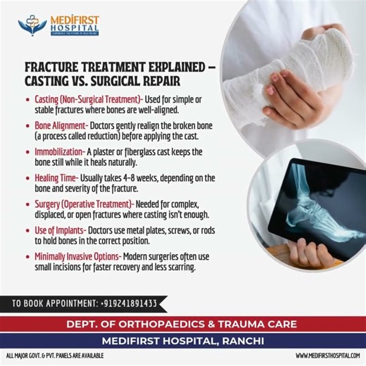 FRACTURE TREATMENT EXPLAINED – CASTING VS. SURGICAL REPAIR