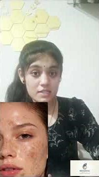 serum lagane ka sahi tarika,# galat serum skin damage 😱,# kaunsa serum best he,# serum mistakes,