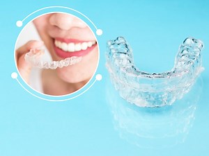 Are You Planning To Get Invisible Aligners? Read These Pros & Cons Before Buying