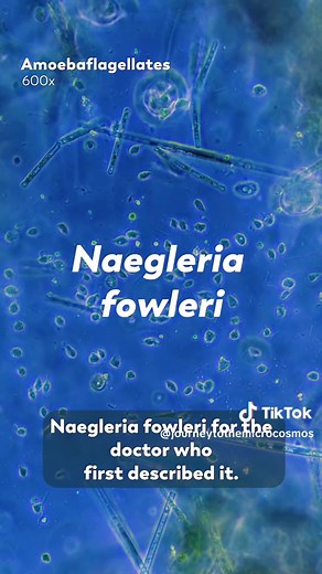 Finding a Brain Eating Amoeba (Footage provided by @Jam's Germs ) #microcosmos #journeytothemicrocosmos #microorganism #microscope #brain #eating #amoeba #found #searching