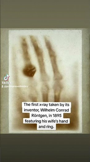 The first x-ray taken by its inventor, Wilhelm Conrad Röntgen, in 1895. #history