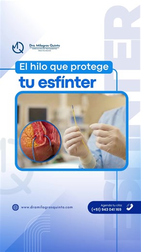 Todo sobre el Setón: Tratamiento de Fístulas