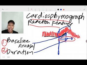 Polygraph Chart interpretation Cardiovascular Activity Cardiosphymograph