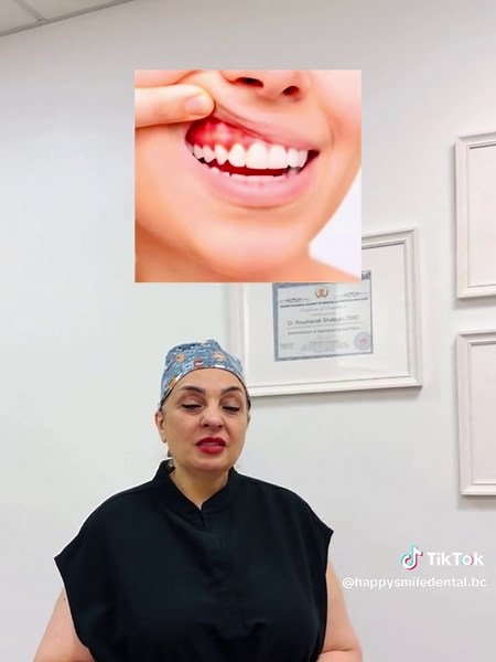 Pros and cons of Teeth Whitening!!!👀😎 . #teethwhitening #whitening #prosandcons #happysmile #dentalclinic #trendingtopic #dentaltok #dentistryworld #viralvideos #oralhealth