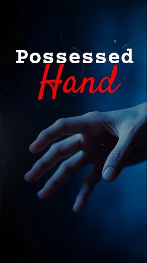 “When Your Hand Turns Against You 😨 | Alien Hand Syndrome Explained”
