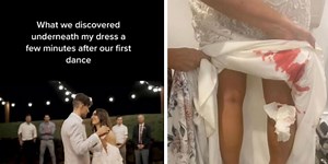 Bride's dress covered in blood after leech attacks her on wedding day