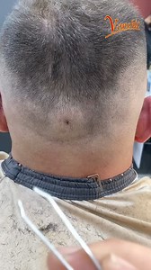 I initially thought it’s a dermal piercing embedded but I could be wrong 🤔 #trend #trendingpost #vonchic | Vonchic.com