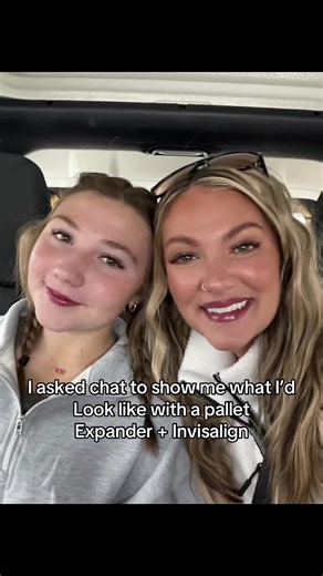 I asked ChatGPT to show me my glow up with a palate expander Invisalign and now I’m emotionally invested 😭🦷 Like & repost so I can secure the new smile pls #creatorsearchinsights #BeautyAndFashion #EverydayGlam #StyleInspo #ShopWithMe