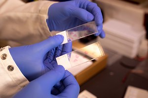 Understanding Inflammation in the Heart - News Center