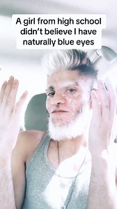 Who has blue eyes? #blueeyes #waardenburgsyndrome #vitiligo #asl #deaf #signlanguage #highschool | Faiz Jamal
