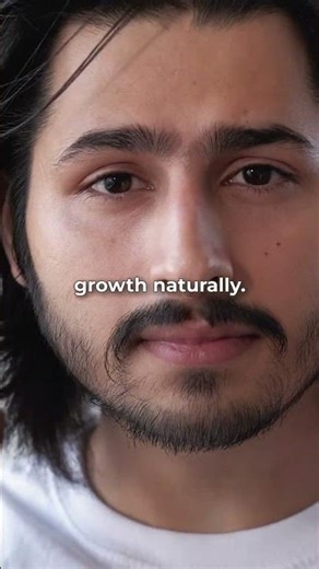 🚀 Regrow Your Hair Naturally with Advanced Non-Surgical Treatments at Shine & Smooth! 🌿