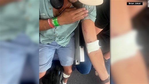 "Abrí los ojos y había varias personas en el techo del avión", pasajero de un avión de Boeing describe caída en pleno vuelo