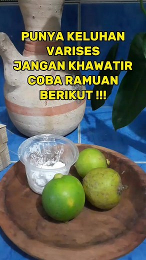 Tips atasi varises secara alami #herbal #ramuan #tips #kakivarises #varises