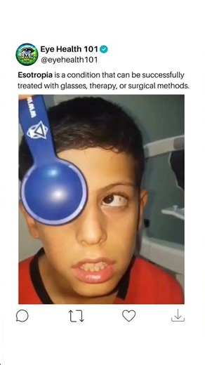 Strabismus (esotropia) is treatable with glasses, therapy, or surgery.