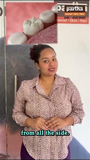 Crown or Veneer? This Simple Analogy Will Clear Your Doubt! #parthaclinic #dentist #trending #viral