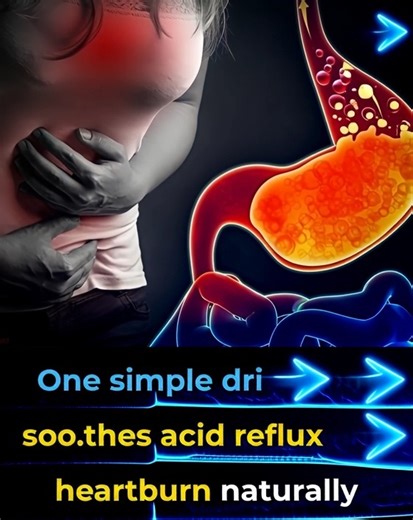 Say goodbye to heartburn this drink helps soothe acid reflux fast | Feedy TV