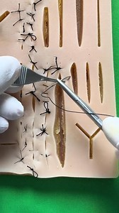 Vertical mattress stitch | Dermhacks