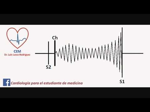 Soplo de la estenosis mitral