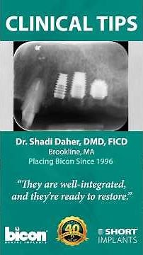 Bicon Minute EP 50 - Immediate Molar Placement without Sinus Risk with Dr. Daher