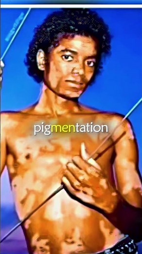 The Truth About Michael Jackson’s Skin Condition 😢