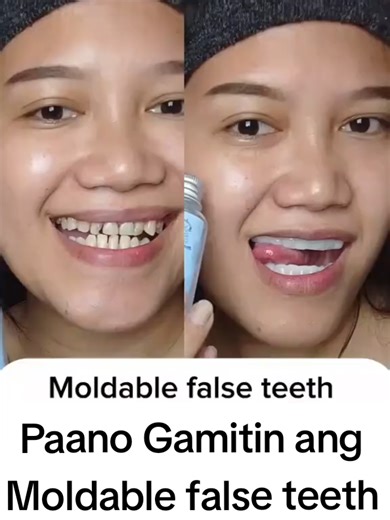Moldable false teeth paano Gamitin here's a short tutorial, sa may gustk check niyo yellow basket natin #moldablefalseteeth #ngipin #falseteeth #resin #how