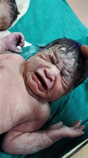 Cesarean delivery (c-section) #newborn #life #respectmother #love #support