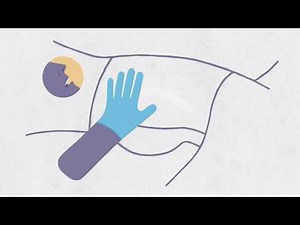 How To Give A Suppository Or Enema