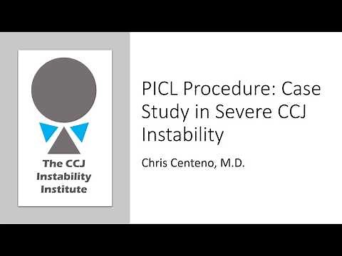 PICL Procedure Case Study in Severe CCJ Instability (aka "craniocervical instability" or CCI)