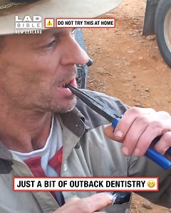 1.3M views · 4.3K reactions | How dentists do it in the outback 藍 | LADbible New Zealand | Facebook