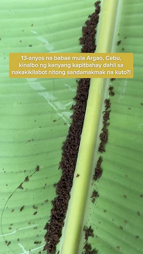 13-anyos na babae mula Argao, Cebu, kinalbo ng kanyang kapitbahay dahil sa nakakikilabot nitong sandamakmak na… kuto?! #KMJS