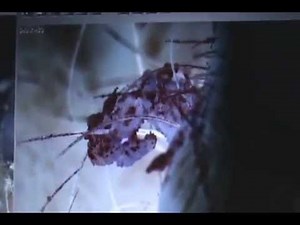 ~ DISAPPEARING MORGELLONS ~