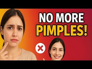 Pimples ?? | 7 Days Use Simple Steps To Remove Pimples & Get Clear, Spotless Skin (Naturally)