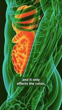 Q&A with a gastroenterologist: Crohn's disease vs. Ulcerative colitis