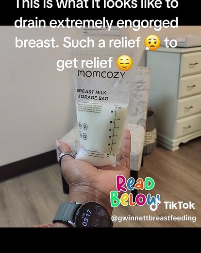 Breastfeeding Pain and Engorgement Solutions