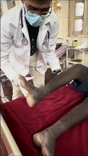 Master Ankle clonus in 60 seconds | Quick clinical guide